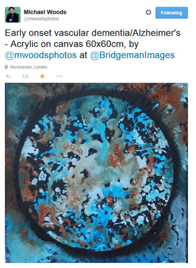 819 Blog MichaelWoods EarlyVasc 4in100ppi